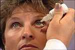 NearVisionSM CK (Conductive Keratoplasty)